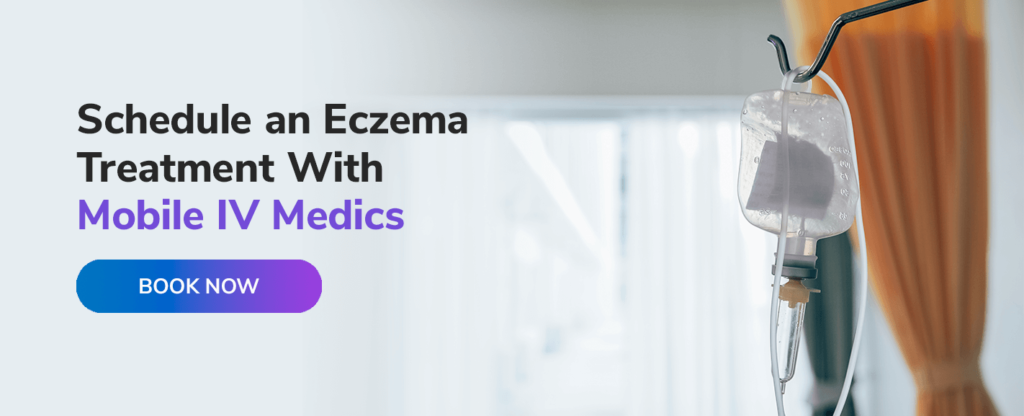 Schedule an Eczema Treatment With Mobile IV Medics