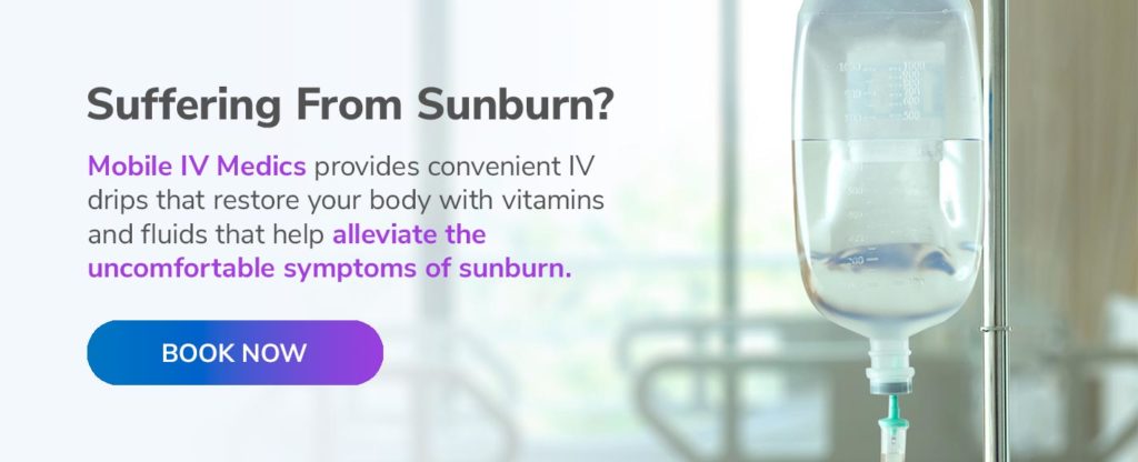 Suffering From Sunburn?