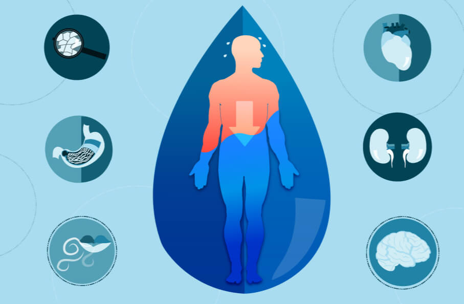 Dehydration affects multiple organ systems