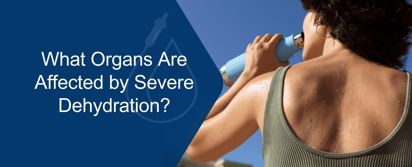 What organs are affected by severe dehydration