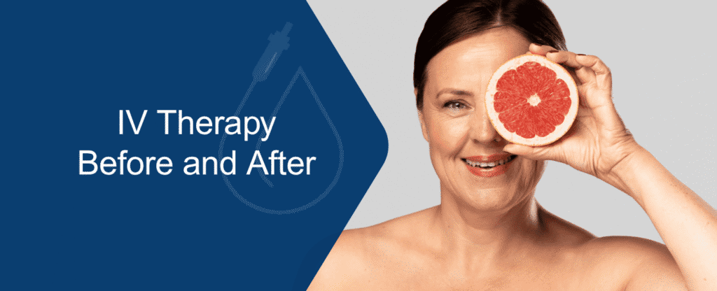 IV Therapy Before and After: What to Expect at Every Stage