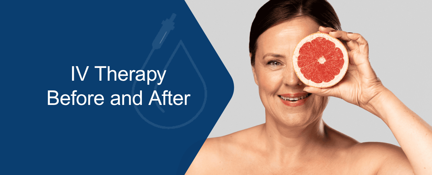 IV Therapy Before and After: What to Expect at Every Stage | Mobile IV Medics IV Therapy Before and After: What to Expect at Every Stage | Mobile IV Medics