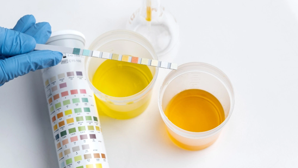 Darker urine color is a sign of dehydration